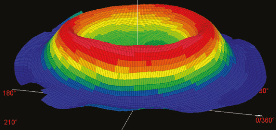 Topografia Corneale a Seguito di trattamento di Ortocheratologia